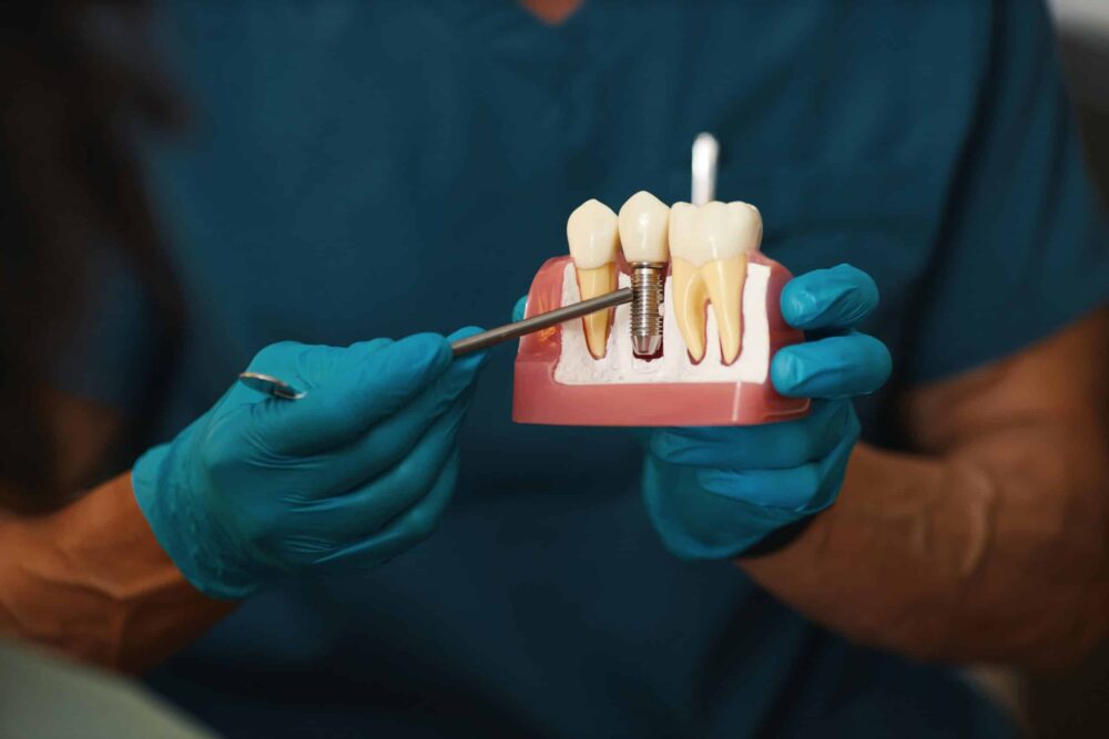Dental Implants Vacaville
